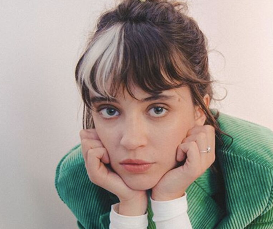 chanteuse pomme avec cheveux blanc vitiligo