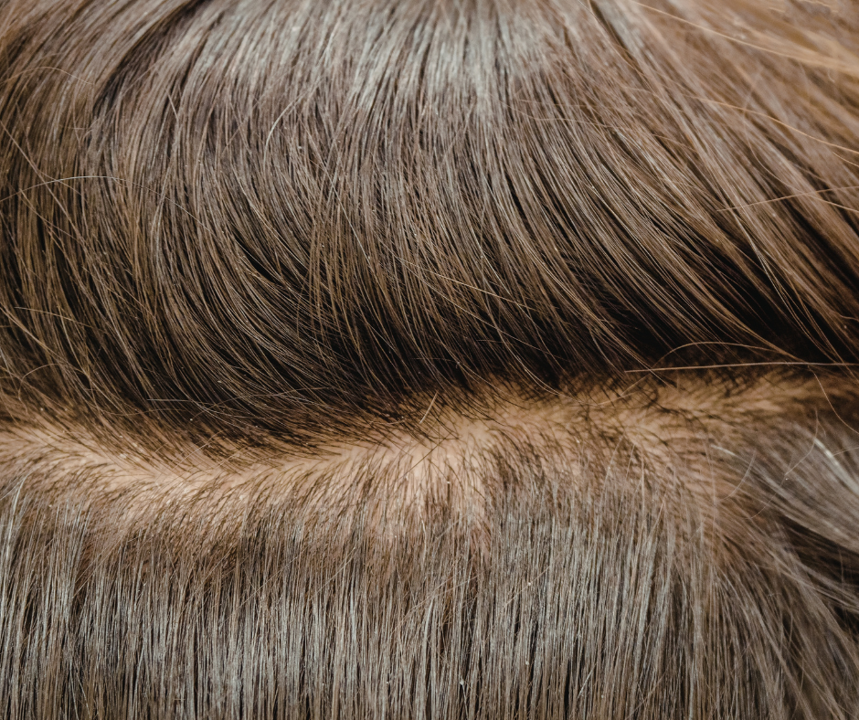 racines cheveux gras remèdes maison