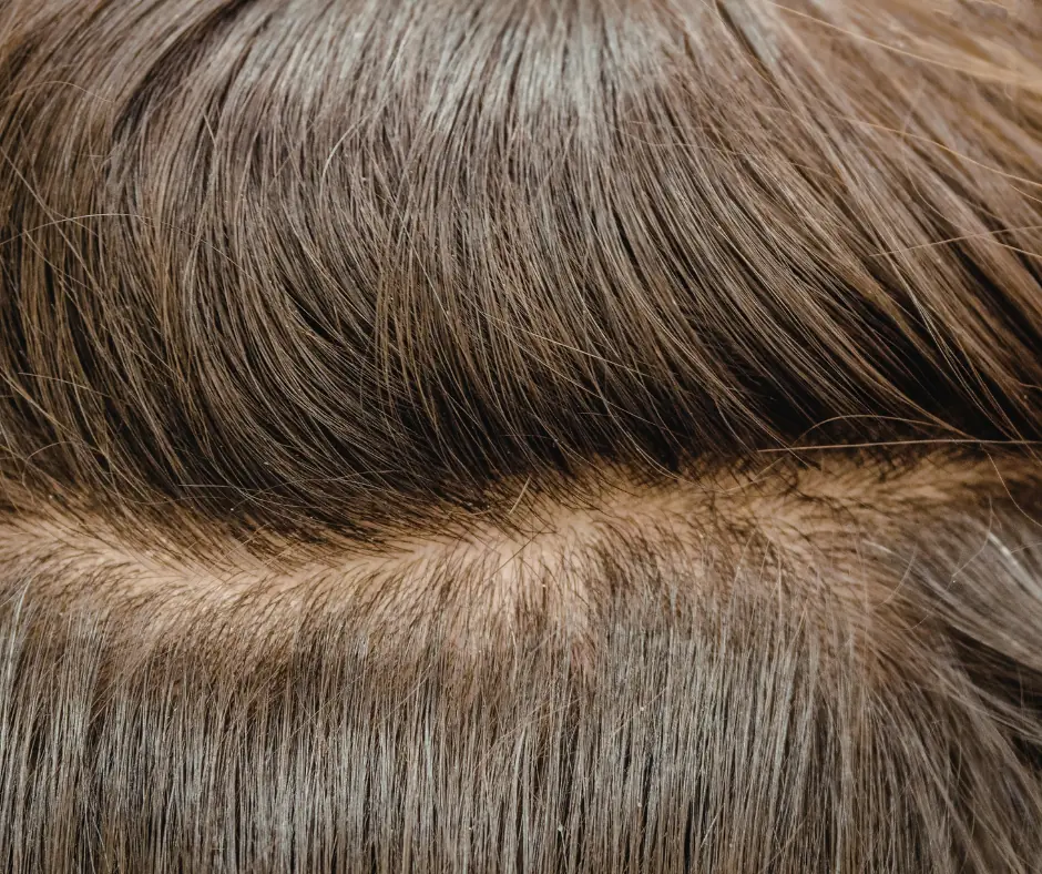 racines cheveux gras remèdes maison